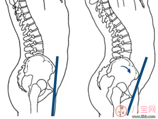 柯基臀|柯基臀是骨盆前倾吗 李菲儿的柯基臀是怎么练成的