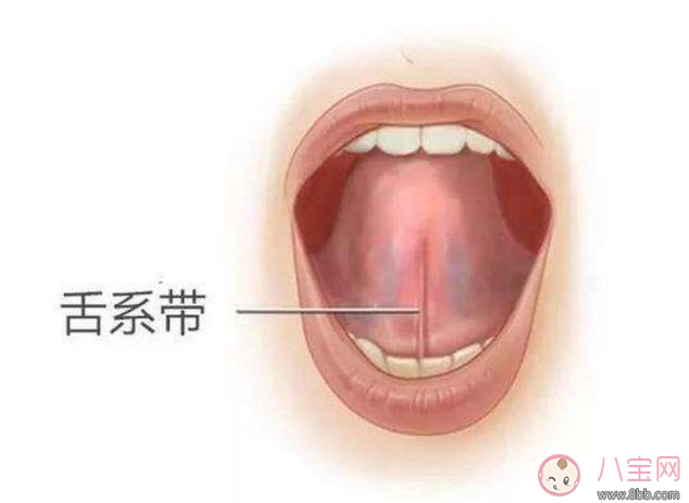 宝宝舌系带过短怎么办 舌系带过短一定要做手术吗