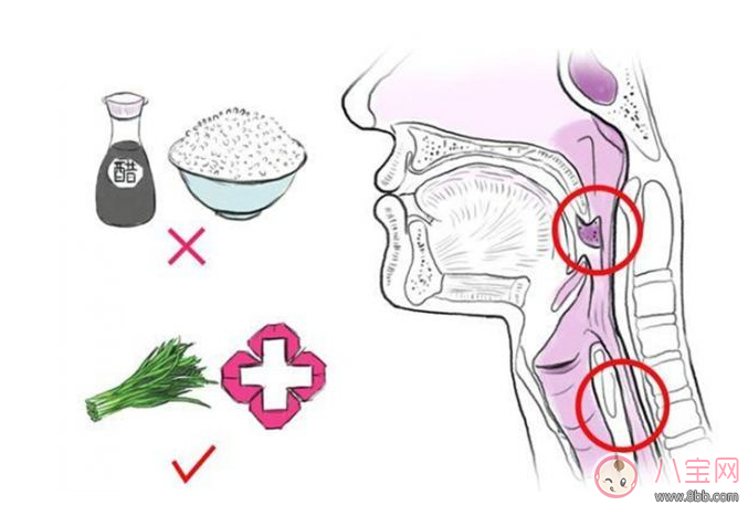 卡鱼刺|宝宝吃鱼卡鱼刺 急着自己去夹刺就大错特错了