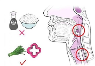 宝宝吃鱼卡鱼刺 急着自己去夹刺就大错特错了