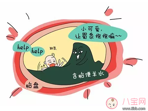 胎儿羊水粪染怎么办 准妈妈怎么应对羊水粪染