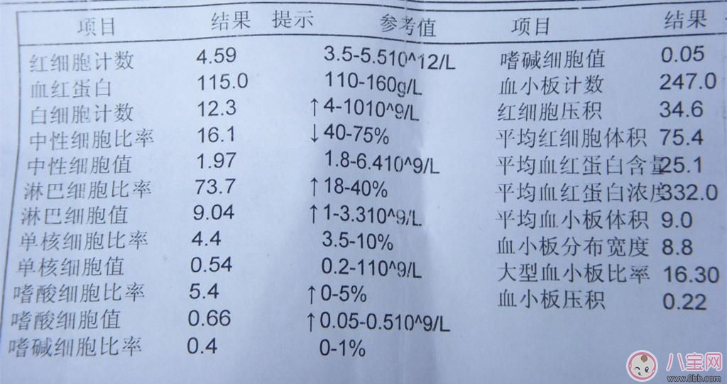 宝宝抽血检验报告怎么看 对应的指数反应了哪些问题