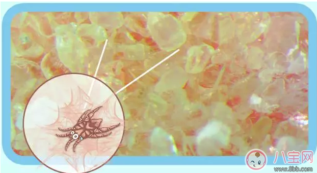 丸荣螨虫贴有用吗 丸荣螨虫贴宝宝用效果好不好