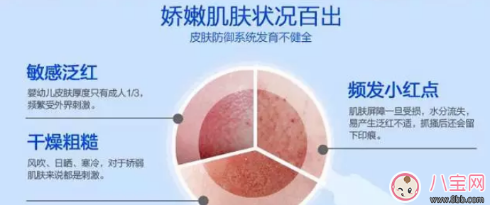 法国妙思乐润肤露宝宝秋冬用效果怎么样 宝宝有小红点干燥问题可以解决吗