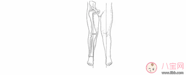 太早站立的宝宝会有问题吗 太早站立究竟会不会造成O型腿