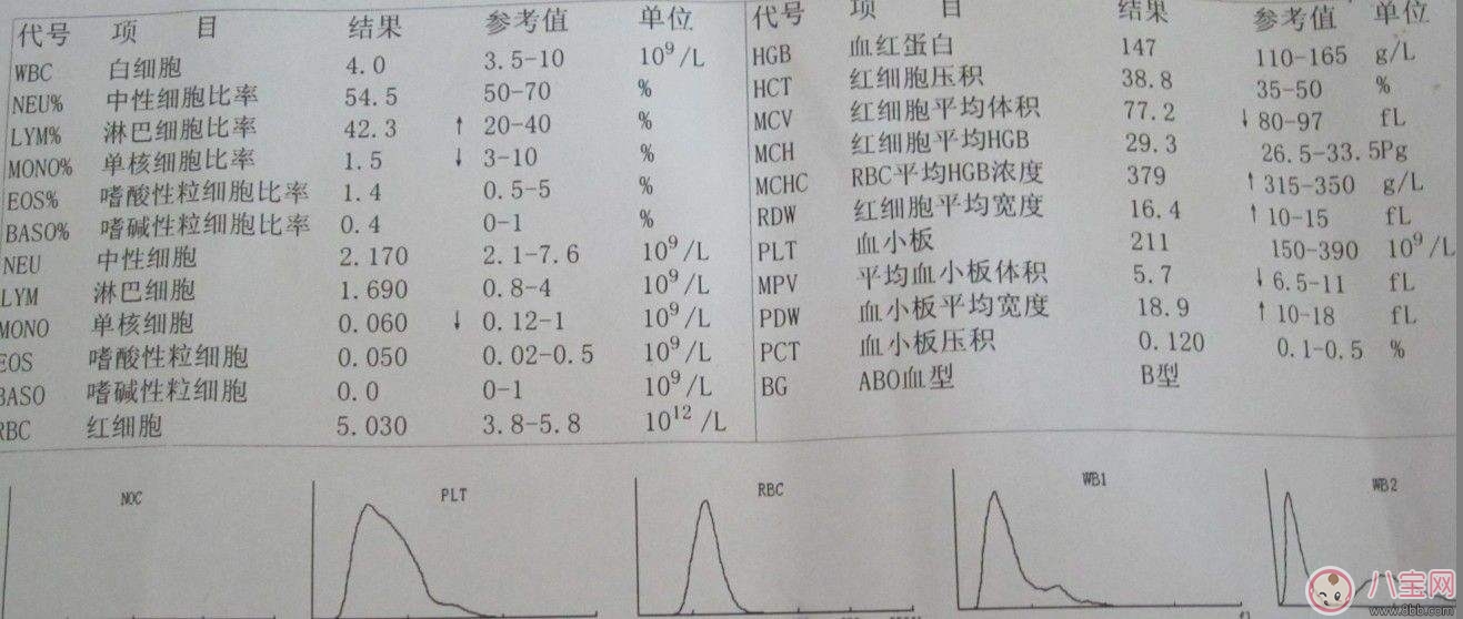 孕期血常规检查要做几次 如何看血常规报告单