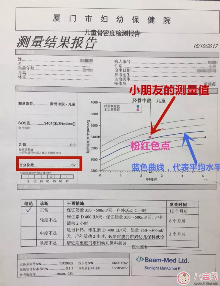 宝宝骨密度报告单怎么看 怎么看懂骨密度检查报告单