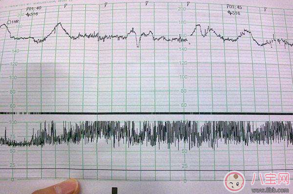 怀孕12周胎心率170有危险吗 准妈妈怎么控制胎心率