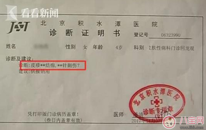 小孩皮肤被针扎了的针眼图片 怎么判断小孩皮肤是否被针扎了