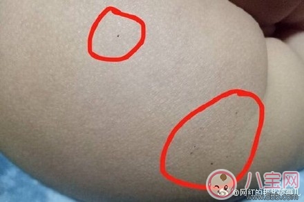 红黄蓝幼儿园孩子针孔注射的什么 为什么幼儿园要跟孩子打针