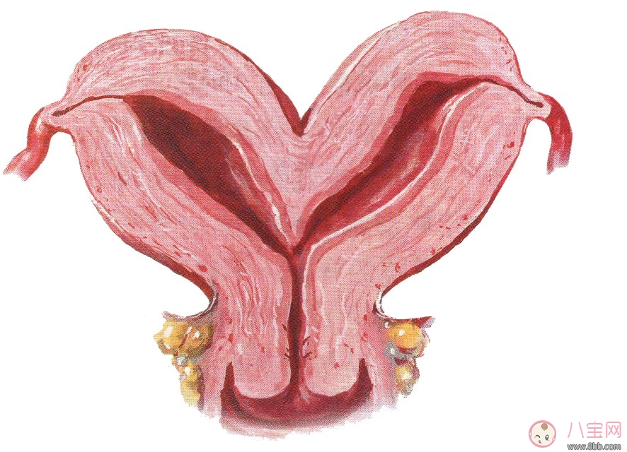 一个阴道,但子宫底部会合不全,导致子宫两侧各有一角突出,称双角子宫