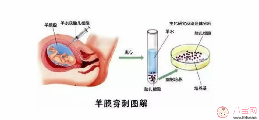 做羊水穿刺风险大吗 羊水穿刺几天能出结果