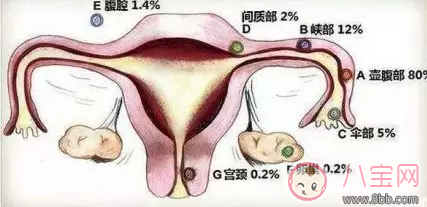 试管怀孕可以避免宫外孕吗 试管怀孕怎么样