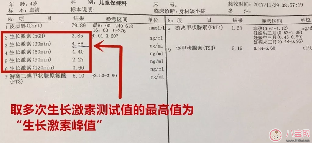 小孩如何检查生长激素 孩子生长激素报告单怎么看