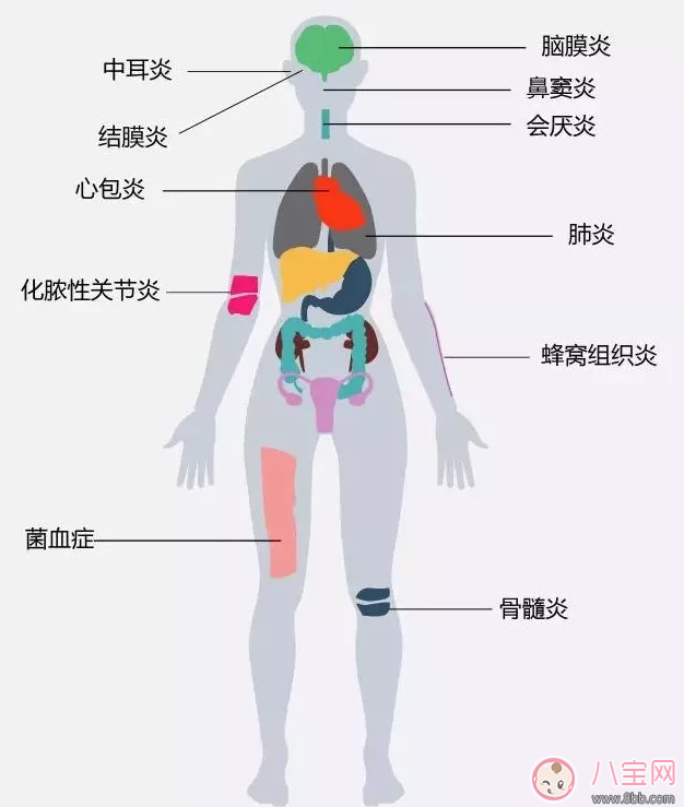 hib疫苗是什么 有必要打hib疫苗吗