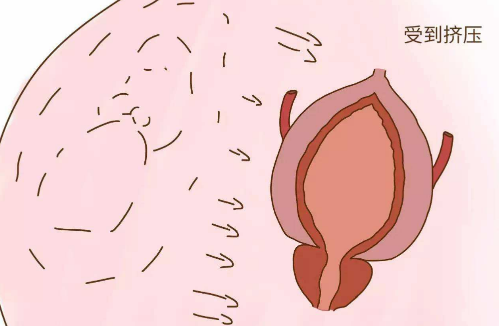 孕期小便频繁怎么回事 孕期尿频什么时候能停止