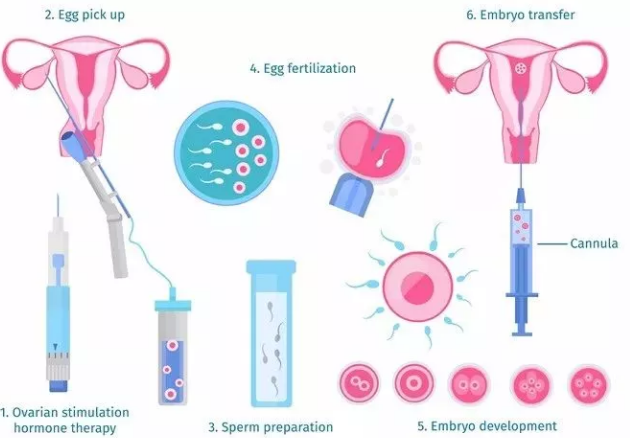 试管婴儿|移植囊胚着床率更高吗2018 试管婴儿选择移植囊胚好不好