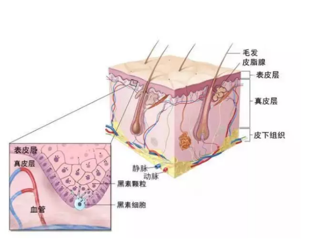 长痘印之后怎么去痘印 淡化痘印有什么方法2018