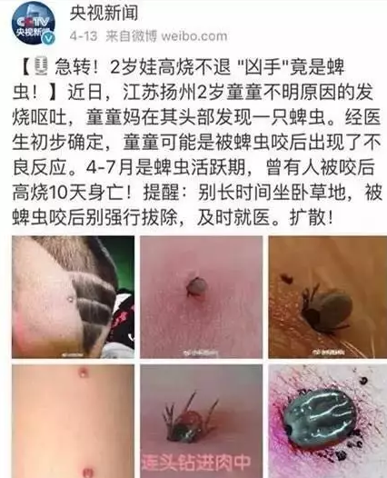 宝宝被蜱虫咬了怎么办 宝宝被蜱虫咬伤正确处理方法