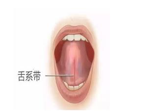 宝宝舌系带短要切吗 怎么判断孩子的舌系带短不短