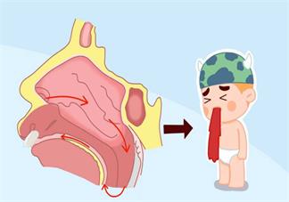 孩子流鼻血是什么原因导致的 怎么预防孩子流鼻血