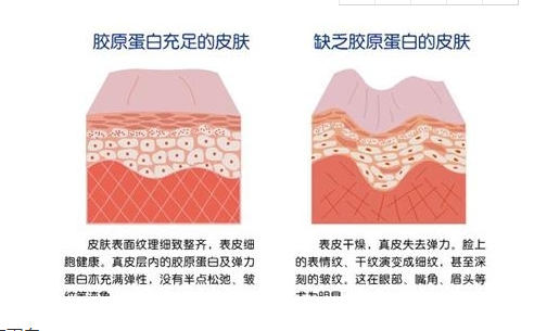 孕妇需要补充胶原蛋白吗   孕妇吃胶原蛋白有什么用