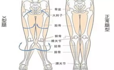 宝宝足外翻怎么办   宝宝足外翻治疗方法