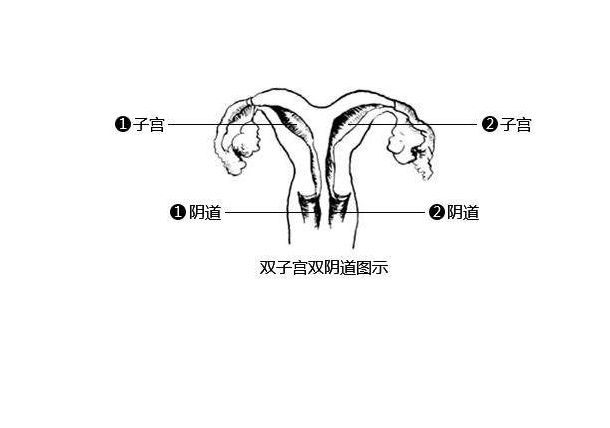 双子宫会影响怀孕吗 双子宫怀孕几率有多大