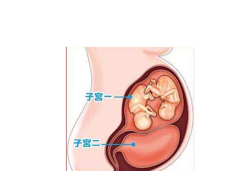 双子宫会影响怀孕吗 双子宫怀孕几率有多大