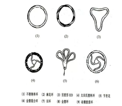 节育环有哪些类型 国内外节育环种类介绍