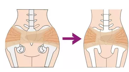 产后盆骨带有用吗 盆骨矫正带作用介绍