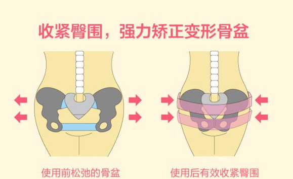 产后骨盆修复有必要做吗 骨盆恢复需要去医院吗