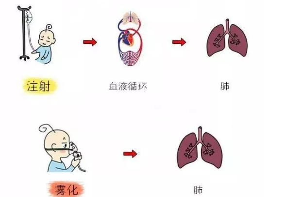 雾化的药物有抗生素吗 雾化的激素药有副作用吗