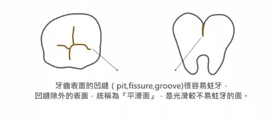 怎么判断孩子是不是蛀牙 孩子长蛀牙怎么保护孩子的牙齿