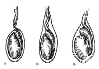 男宝宝的蛋蛋不对称正常吗 宝宝的蛋蛋不对称怎么办