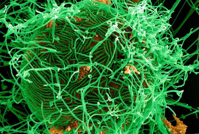 埃博拉病毒能治好吗 感染埃博拉病毒有什么症状
