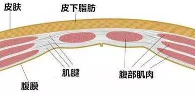 腹直肌分离|腹直肌分离了怎么办 妈妈腹直肌分离还能恢复吗