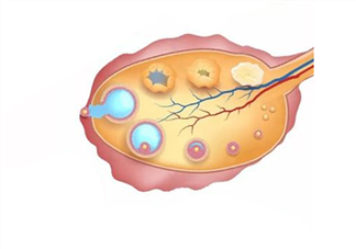 卵巢储备功能下降不好怀孕了吗 女性卵巢功能下降的征兆表现