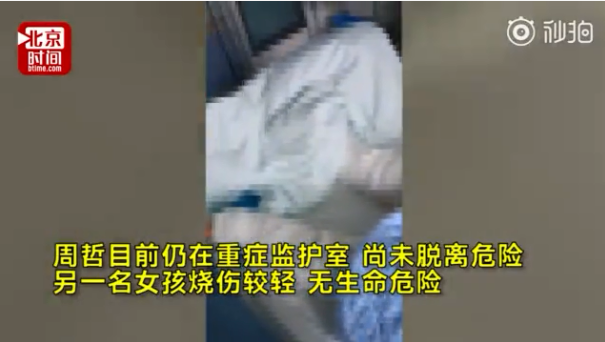 模仿短视频|女孩模仿短视频被重度烧伤是什么情况 模仿易拉罐自制爆米花短视频被烧伤