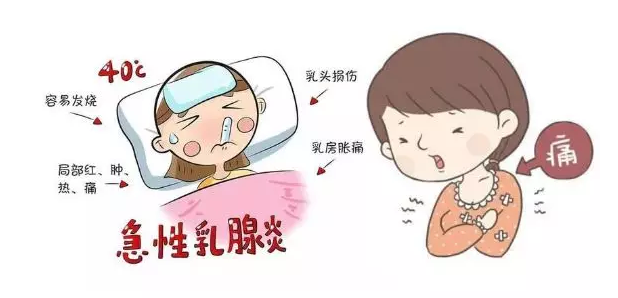 回奶|回奶不当会引发乳腺炎吗 如何正确科学的回奶