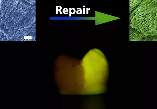 浙大学者发明神奇牙齿修复药水是真的吗 牙齿修复水有什么功效