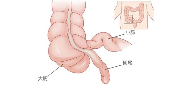 什么是小儿急腹症 儿童急腹症病因