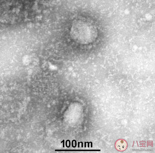 新型冠状病毒肺炎|新型冠状病毒肺炎全国统一最新出院标准是什么 新型肺炎什么程度可以出院