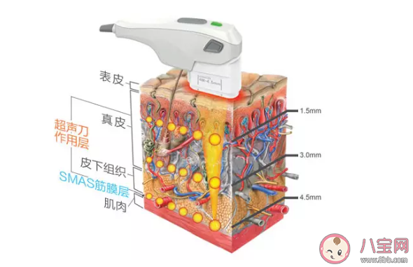 热玛吉的原理是什么 做热玛吉安全吗