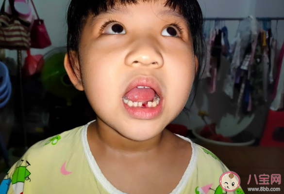 女儿第一次换牙|女儿第一次换牙的发朋友圈说说 女儿第一次换牙心情句子