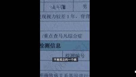 2岁男童近视两千多度怎么回事 马凡综合征是什么