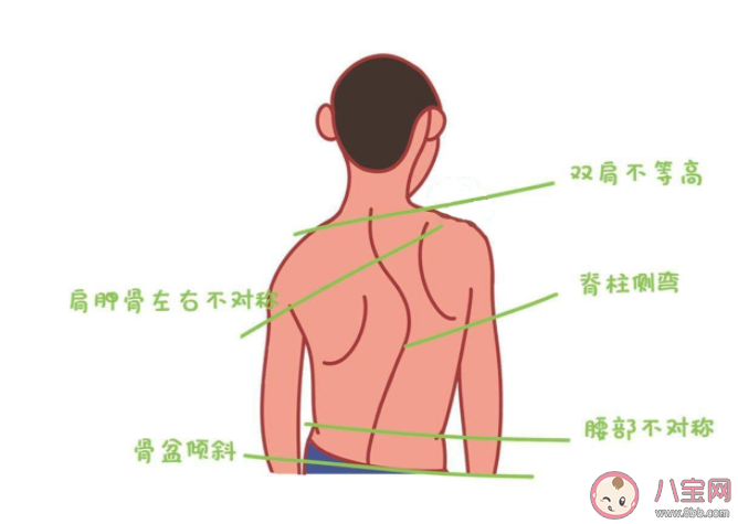 孩子脊柱侧弯长大了就会好吗 青少年脊柱侧弯家长要注意什么