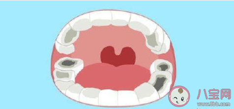 蛀牙真的和吃糖有关吗 如何防止蛀牙