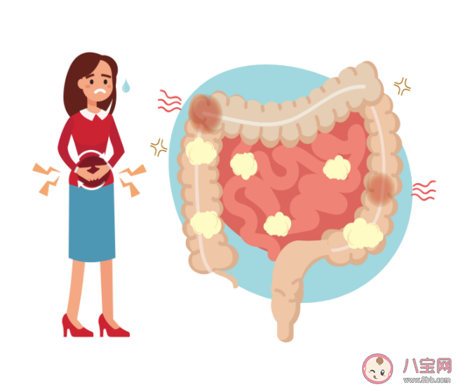 肠易激综合症会引起严重的并发症吗 怎么减轻肠易激综合症的症状