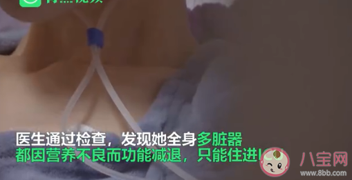 80斤女孩减肥|80斤女孩减肥长期不吃主食进ICU 减肥不吃主食好吗